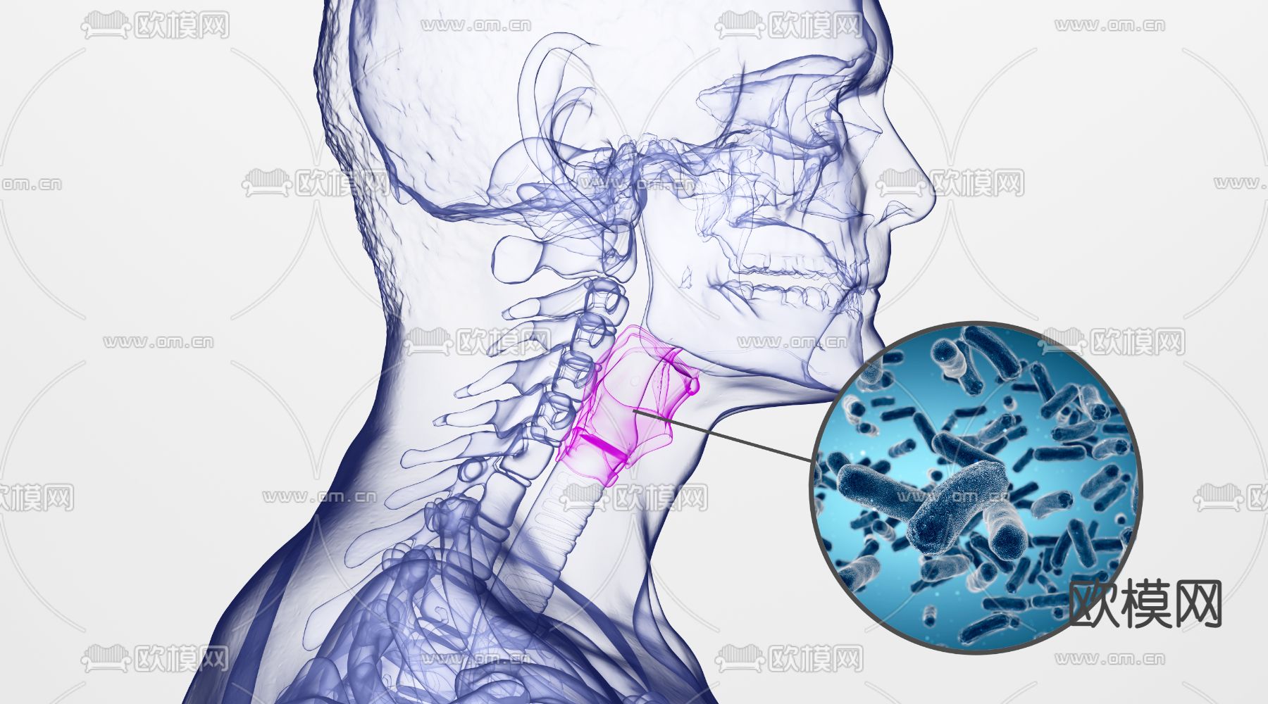 人体咽喉炎3d模型下载