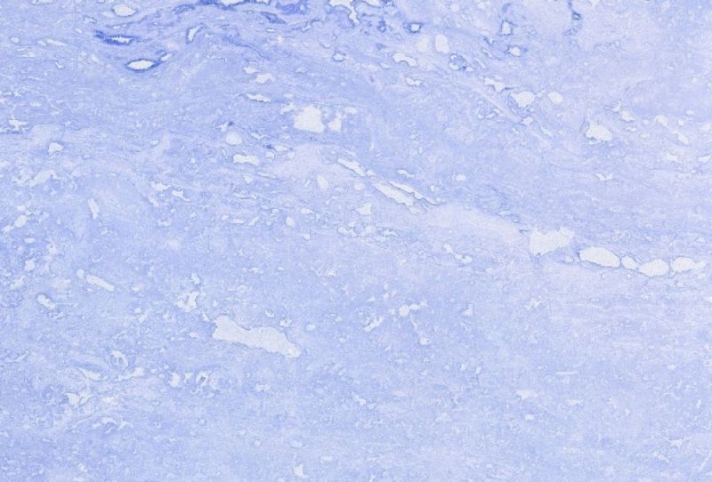 石材-室外瓷砖 003下载