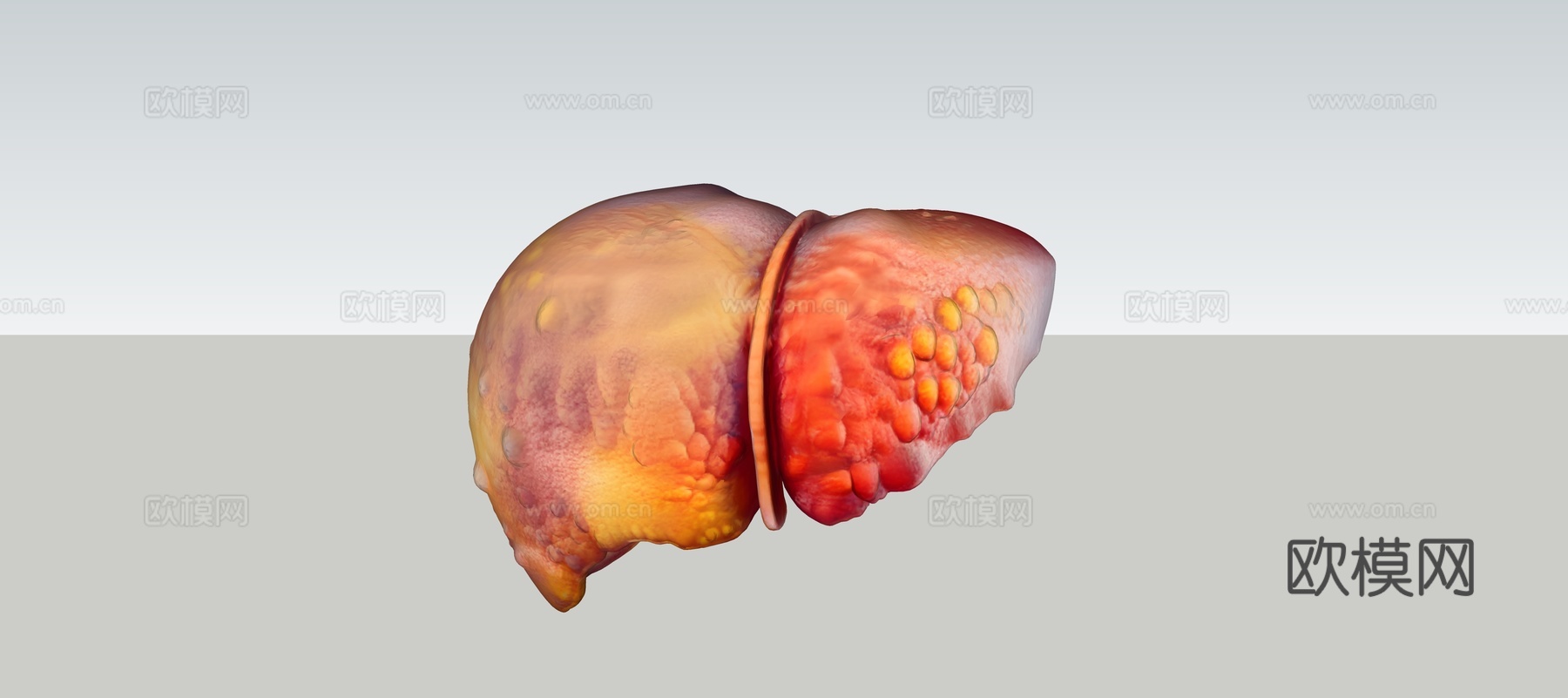 慢性肝病肝脏病变三维可视化su模型